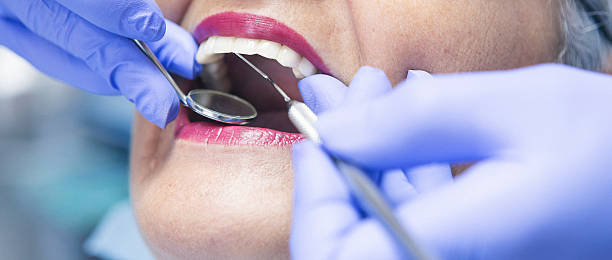 Best Dentist for Tooth Abscess  in Winsted, CT